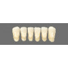 Wiedent teeth Classic fronts 6 pcs Super Price Promotion