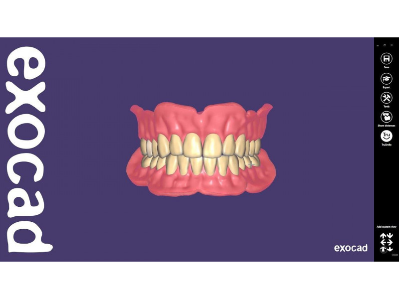 Exocad Full Denture module (full dentures)
