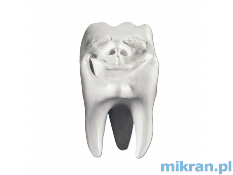 Hinrichs tooth collection ''Backi'' plaster teeth