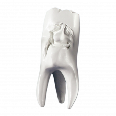 Hinrichs tooth collection gypsum teeth '' Manni ''