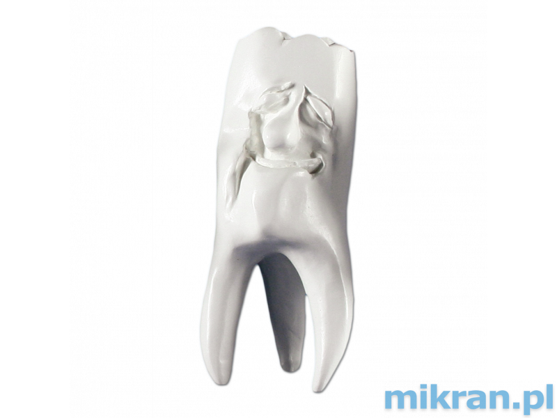 Hinrichs tooth collection ''Manni'' plaster teeth