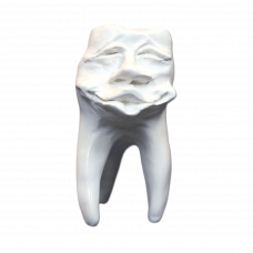 Hinrichs tooth collection ''Mick'' plaster teeth