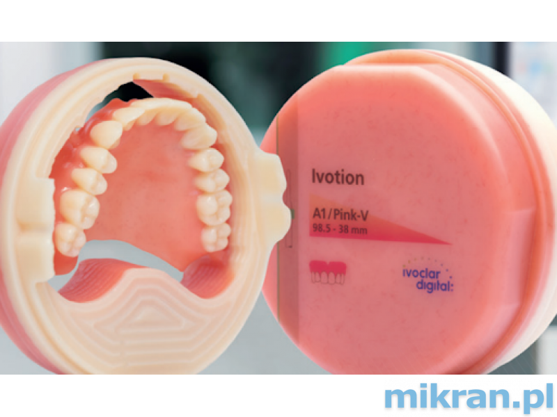 Ivotion Pink-V 98.5U / 38mm upper denture