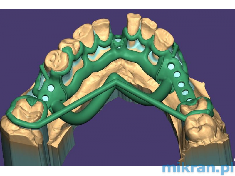 Exocad course - PartialCAD - Design of skeletal prostheses (stationary course)