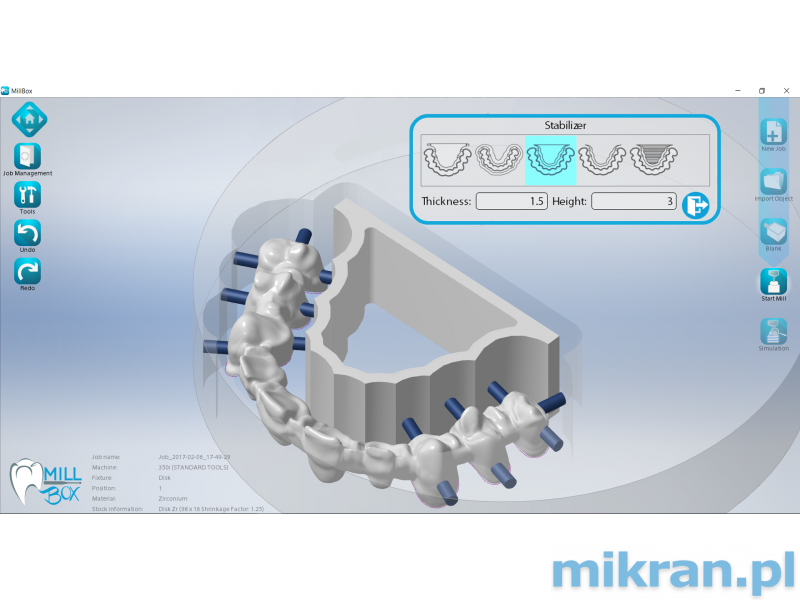 MILLBOX software (versions: Clinic, Eco, Standard, Expert).